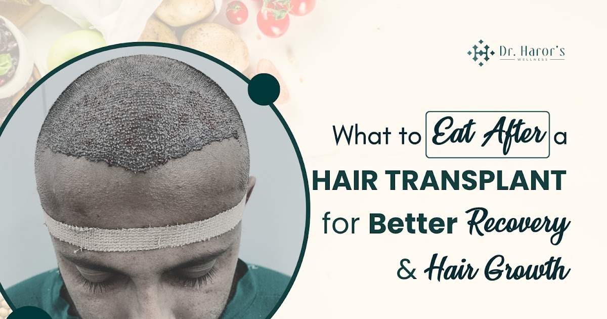What to Eat After a Hair Transplant for Better Recovery & Hair Growth
